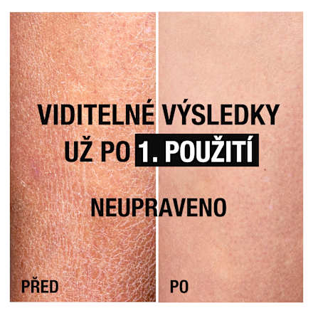 dárková sada Intensive Hydration Care  Neutrogena