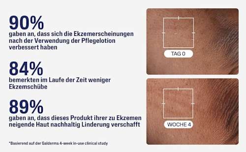 Cetaphil PRO ITCHCONTROL hautberuhigende Pflegelotion Cetaphil