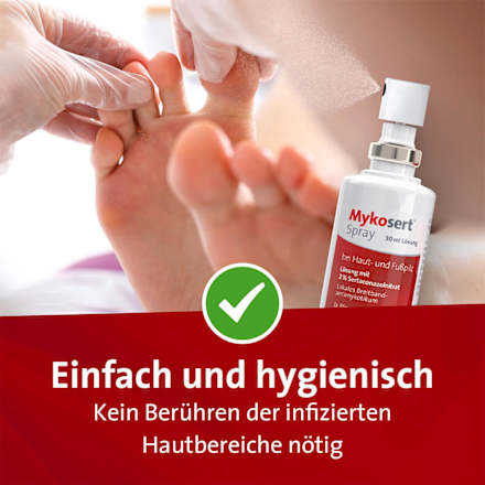 Mykosert Spray, Lösung mit 2 % Sertaconazolnitrat (2x30 ml) Mykosert