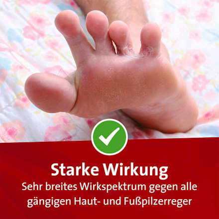 Mykosert Spray, Lösung mit 2 % Sertaconazolnitrat Mykosert