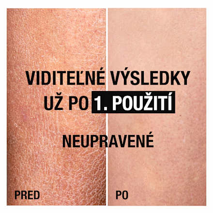 Hydratačné telové mlieko na citlivú pokožku Deep Moisture Neutrogena
