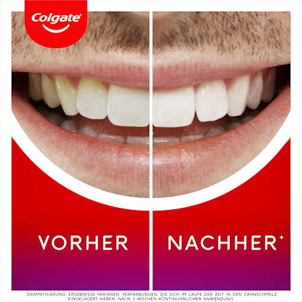 Max White Overnight Whitening Serum Colgate