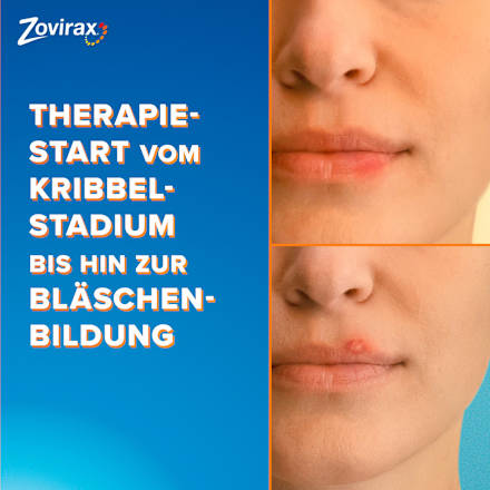 Zovirax Lippenherpescreme Aciclovir 5% Zovirax