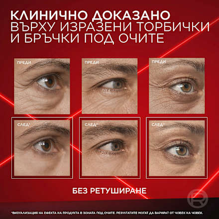 Гел за околоочен контур Eye Bag Instant Eraser L'ORÉAL PARiS REVITALIFT