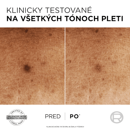 Pleťové sérum proti tmavým škvrnám Bright Reveal Niacinamide Dark Spot L'ORÉAL PARiS