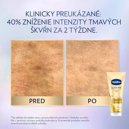 Telové sérum Gluta-Hya Flawless Tone Vaseline