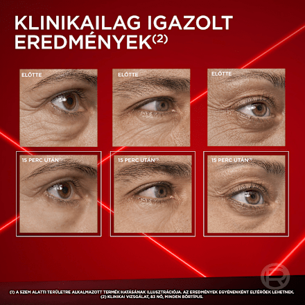 Nappali ápoló a szemek alatti táskákra Revitalift Laser L'ORÉAL PARiS REVITALIFT