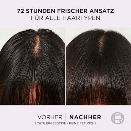 Shampoo Hydra [Hyaluronic] Pure L'ORÉAL PARiS ELVITAL