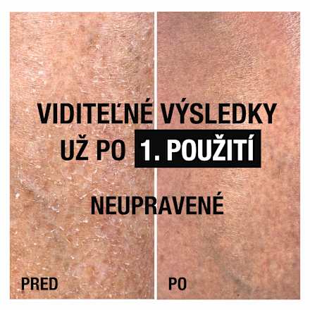 Regeneračné telové mlieko Intense Repair Cica Neutrogena