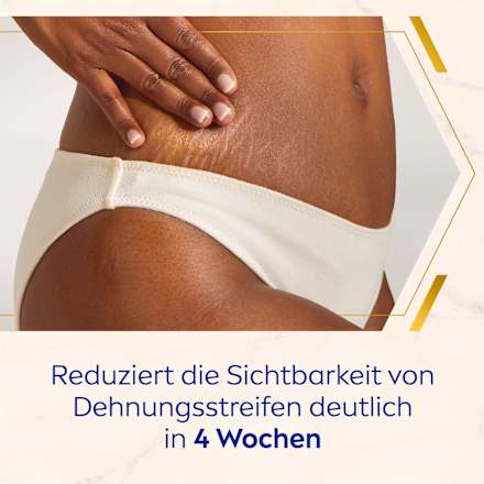Bodycreme Luminous Anti-Dehnungsstreifen NIVEA