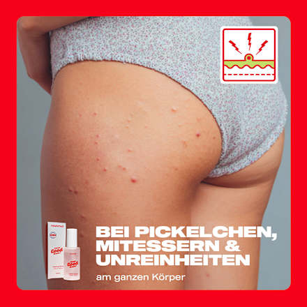 Peeling Spray Solution nevernot