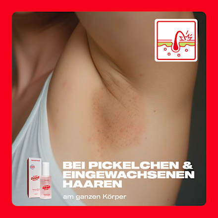 Peeling Spray Solution nevernot