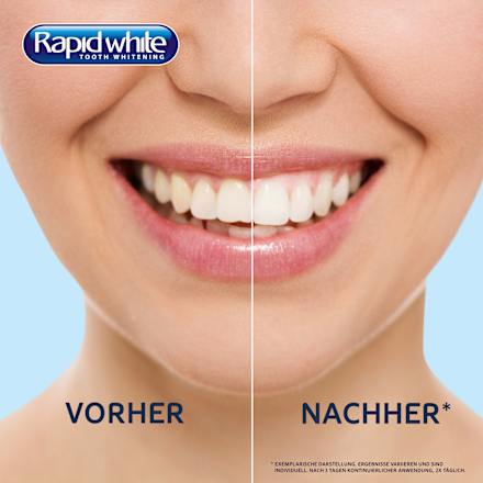 Bleaching Strips  Rapid white