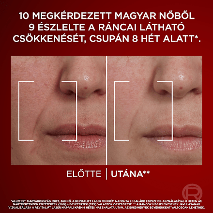 Nappali arckrém Revitalift laser x3 L'ORÉAL PARiS REVITALIFT