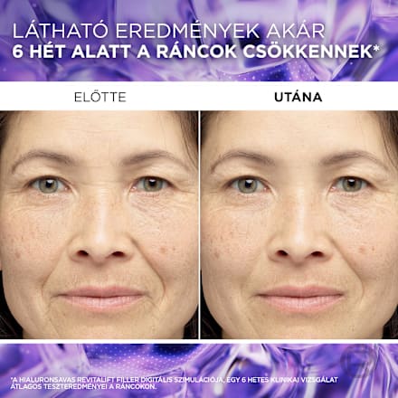 Revitalift filler szérum, hyaluronnal L'ORÉAL PARiS REVITALIFT