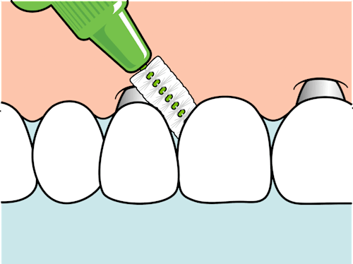 Perii interdentare,verde TePe