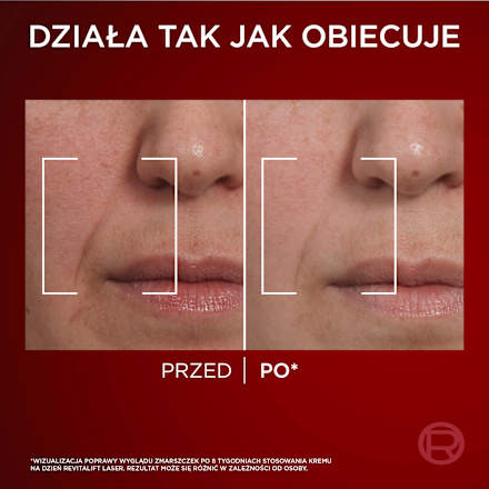 Revitalift Laser X3 Krem przeciwzmarszczkowy na dzień  L'ORÉAL PARiS