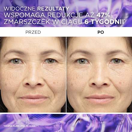 Revitalift Filler Serum przeciwzmarszczkowe do twarzy z 1,5% czystego kwasu hialuronowego  L'ORÉAL PARiS