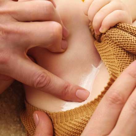 Wundschutzcreme Calendula Parfümfrei WELEDA baby