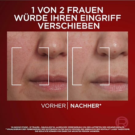 Anti Age Nachtcreme Revitalift Laser X3 L'ORÉAL PARiS REVITALIFT