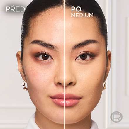 Magic BB krém 5 v 1, Medium L'ORÉAL PARiS