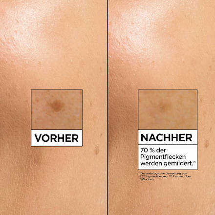 Serum Vitamin C Glow Booster Anti-Dunkle-Flecken Garnier Skin Active