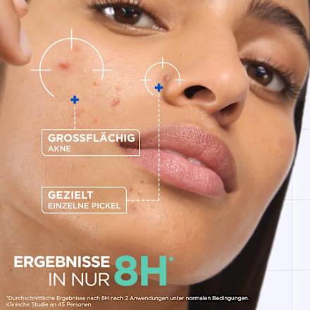 Anti Pickel Paste Mixa