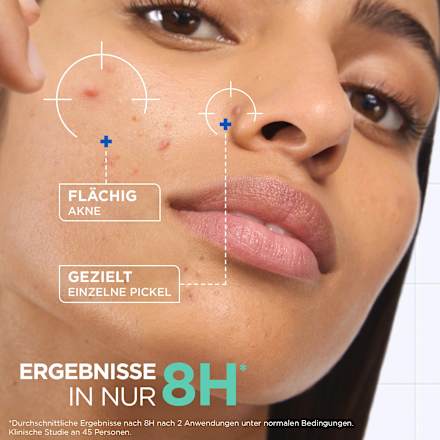 Anti Pickel Paste Mixa