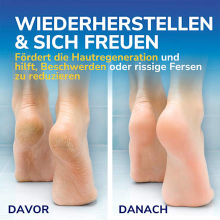 Fußcreme active repair K+ mit 25% Urea & Keratin Scholl