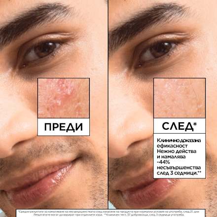 Серум против несъвършенства Salicylic  GARNIER