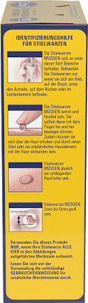 Stielwarzen-Entferner Scholl