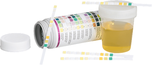 Urin-Kontrolltest 11 Parameter Elanee