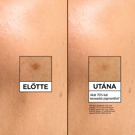 Arcápoló szérum C-vitaminnal + niacinamiddel + szalicilsavval GARNIER SKIN NATURALS