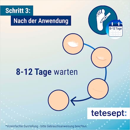 Warzen Vereiser tetesept