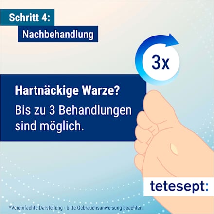 Warzen Vereiser tetesept