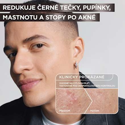 sérum proti nedokonalostem GARNIER PureActive