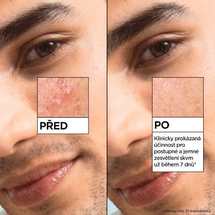 pleťové sérum Salicylic  GARNIER PureActive