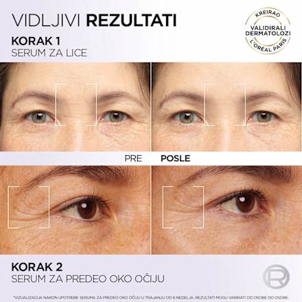 REVITALIFT FILLER anti-age serum za područje oko očiju - hijaluronska kiselina i kofein L'ORÉAL PARiS