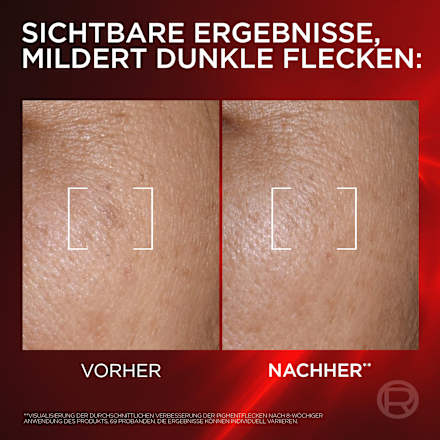 Gesichtsserum Revitalift Laser Triple Power Creamy L'ORÉAL PARiS