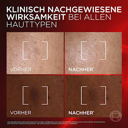 Anti Age Gesichtsserum Revitalift Laser Dreifach Laser L'ORÉAL PARiS