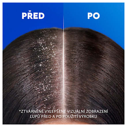 šampon na vlasy Menthol Fresh head&shoulders