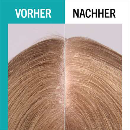 UV-Schutz Spray Scalp Balance LSF 20 Schwarzkopf GLISS