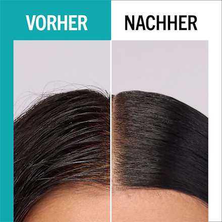 Haarserum Scalp Balance Oil-Control-Komplex Schwarzkopf GLISS