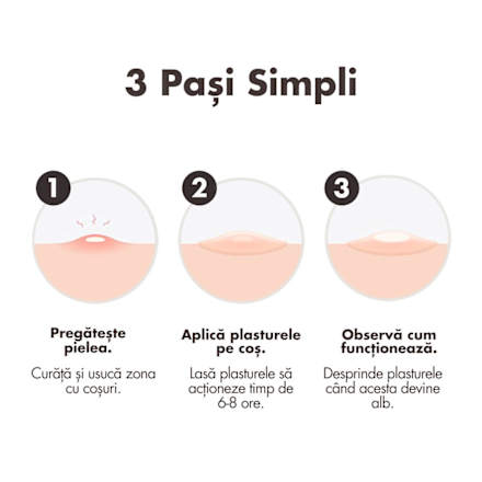 Plasturi hidrocoloidali pentru acnee duo Hero.