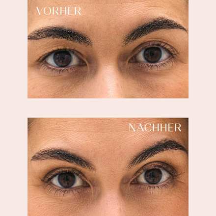 Anti-Schlupflider Tapes  PARSA BEAUTY