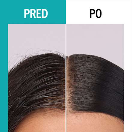 Hĺbkovočistiaci šampón na vlasy scalp balance DEEP CLEANSING Schwarzkopf GLISS