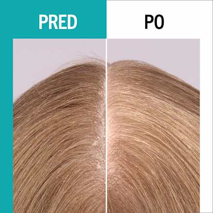 Hydratačné sérum na vlasy scalp balance  Schwarzkopf GLISS