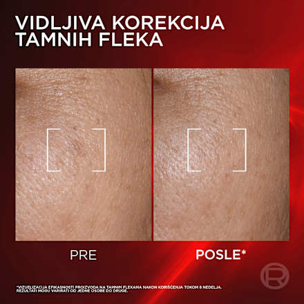 Revitalift Triple Action Serum za lice L'ORÉAL PARiS REVITALIFT