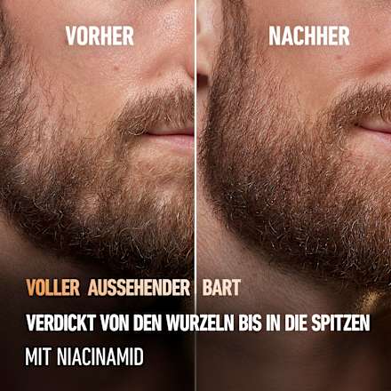 Bartvolumen Serum King. C. Gillette