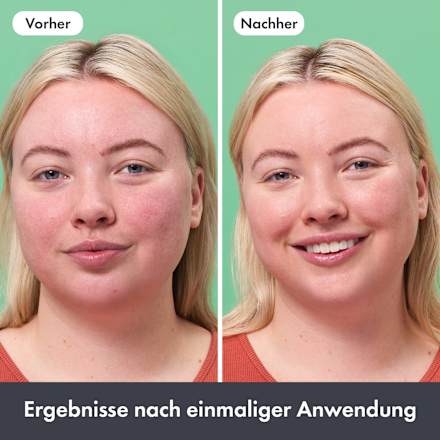 Rescue Balm Red Correct  Hero.